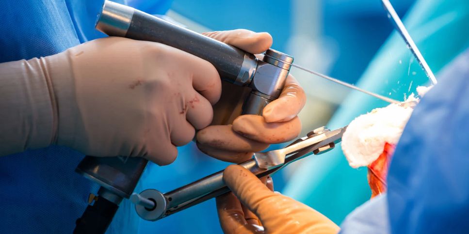 CPT 64721 in carpal tunnel surgery